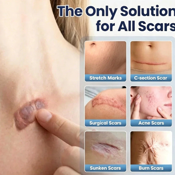 Scar Repair Cream