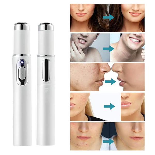 ClearSkin Home Laser Pen