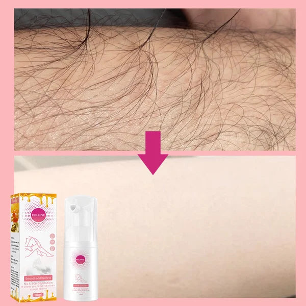 HairAway™ - Rapid Hair Removal Spray