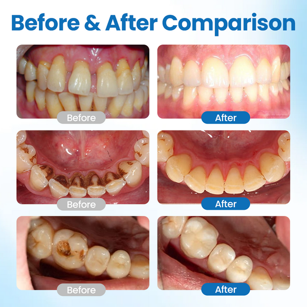 Enamel TeethGuard Nano Serum