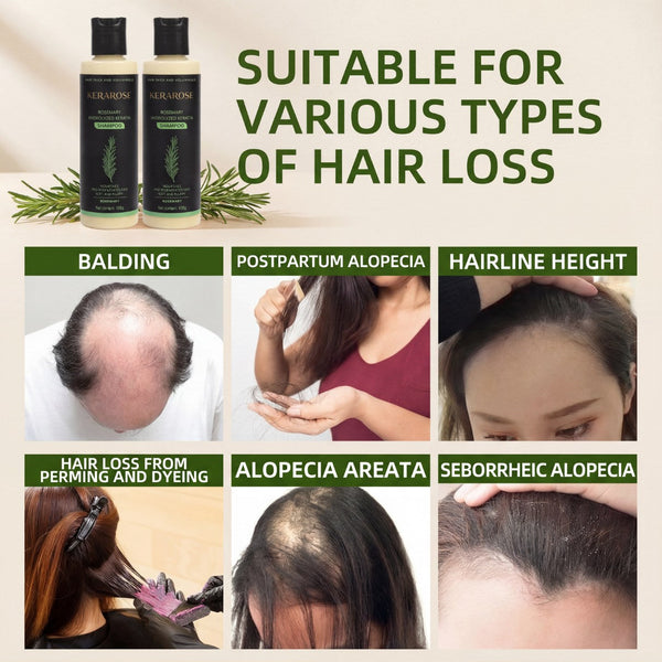 ThickRoot Rosemary Hair Shampoo