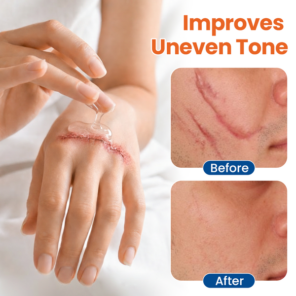 DermalRebuild Skin Gel