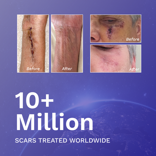 Velora Silicone Scar Gel