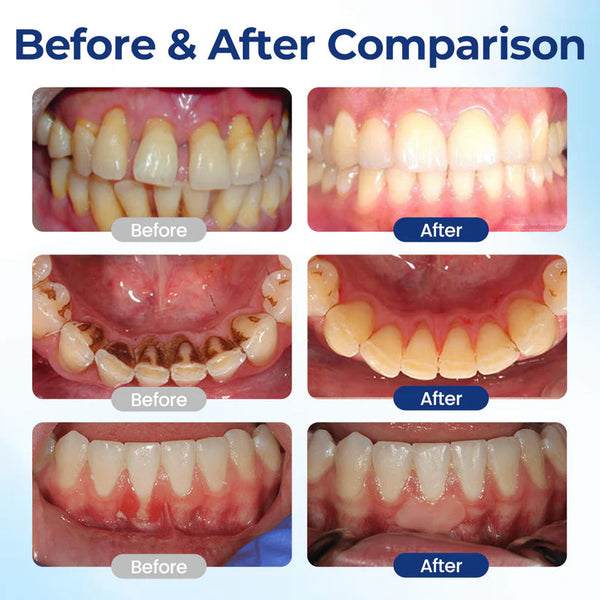 BeeTakt Oral Repair Serum