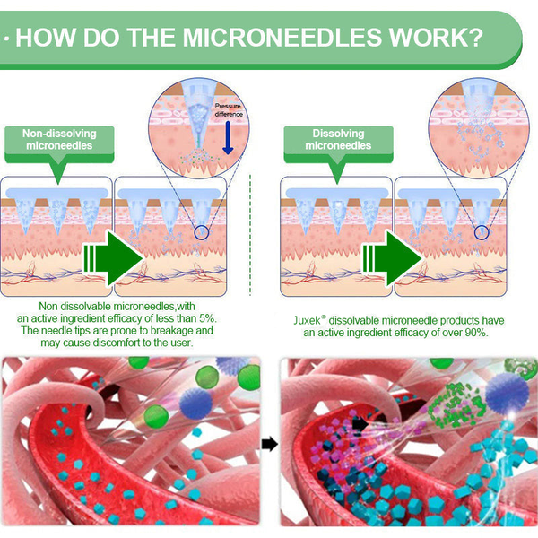 NanoTrim Microneedle Patch