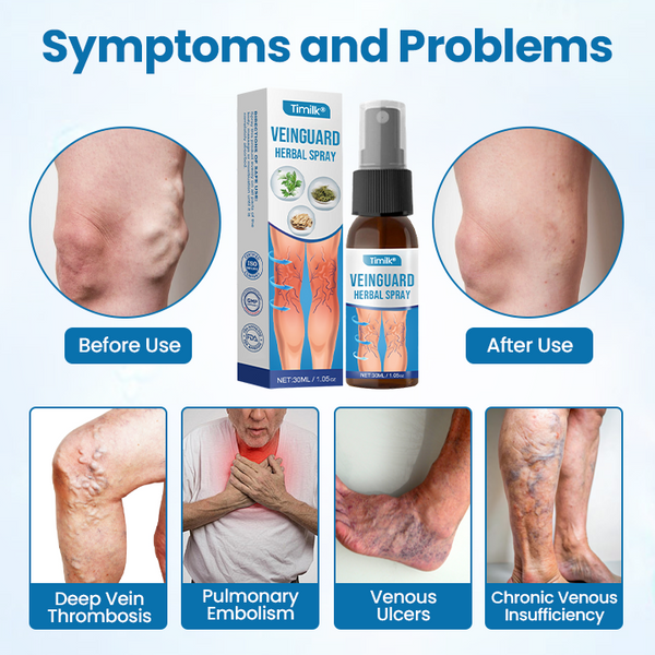 Vein Herbal Relief Spray