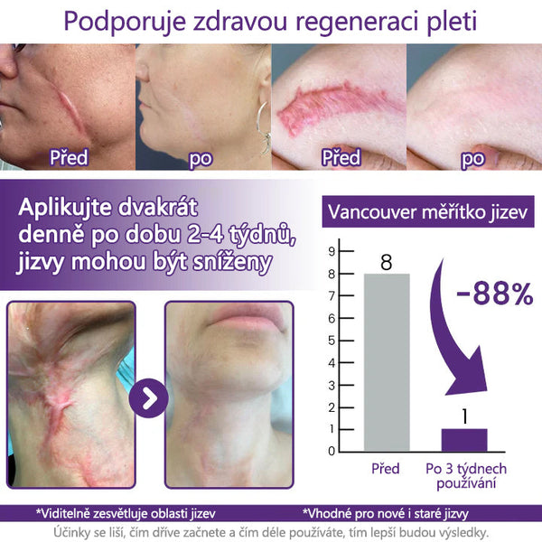 ReGenScar SkinHeal Scar Remove Gel