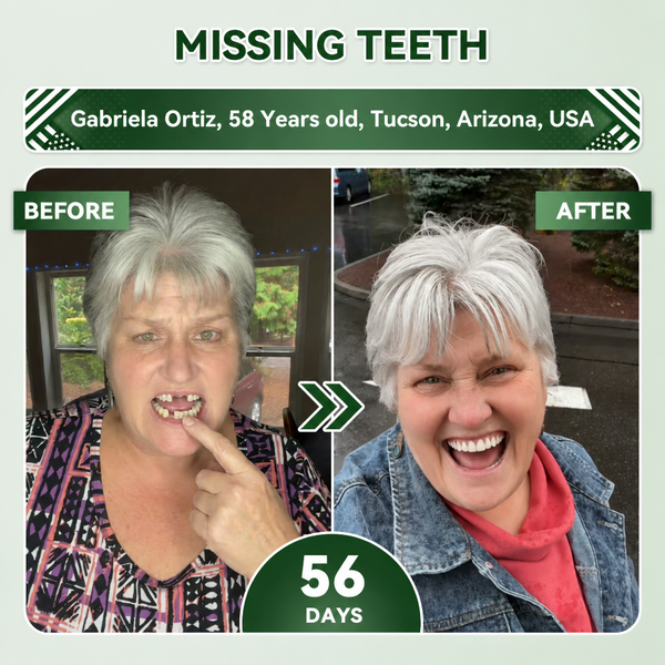 SmileRenew Fast Dental Repair Strips