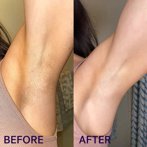 SmoothEase Hair Removal Cream