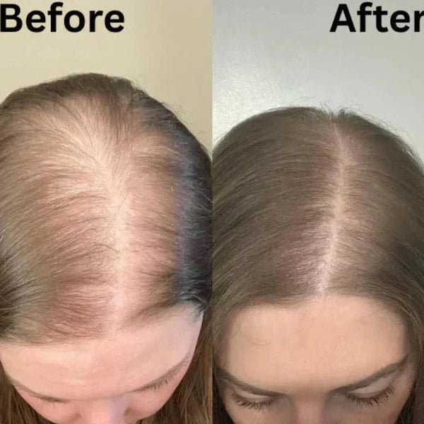 ThickRoot Rosemary Hair Shampoo
