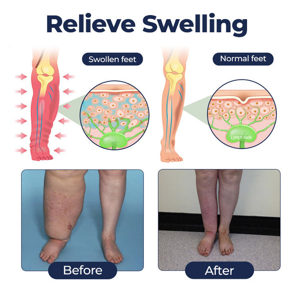 SwellRelief Circulation Cream