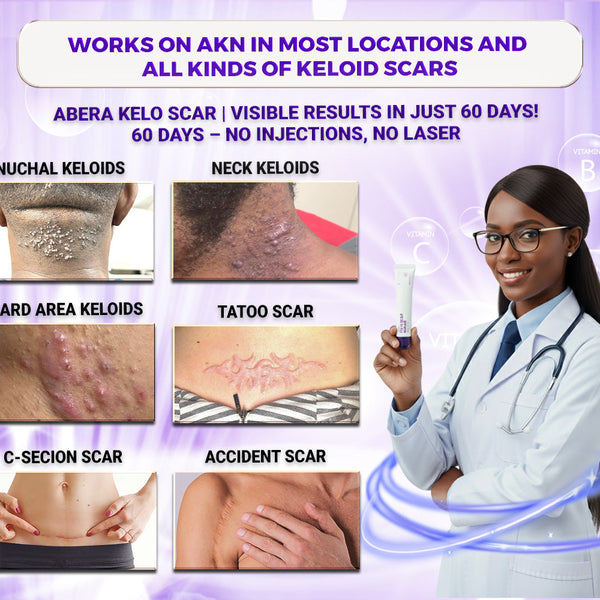 Kelo Scar Repair Cream