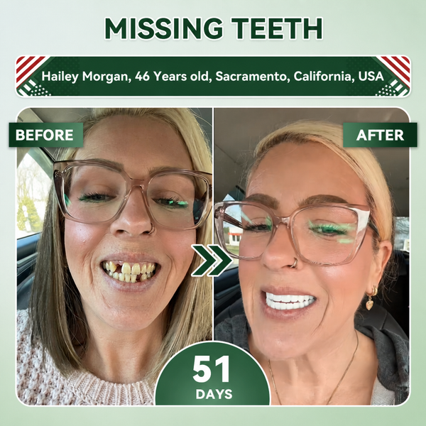 SmileRenew Fast Dental Repair Strips