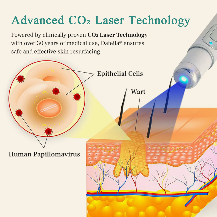 LumeSkin Mole and Wart Instant Removal Laser Pen