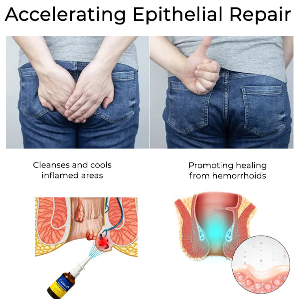 Herbal Hemorrhoid Treatment Anal Spray